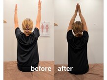 リファイン整体院 国分寺店/姿勢改善、肩こり、腰痛、整体