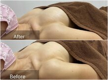 ルナリア ルクス 志木南口駅前店/若々しいあの頃に！ハリ弾力 