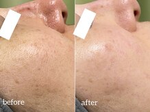 サロンリー(Salon Riee)の雰囲気（こつこつシミを排出！白光する肌に誰でもなれる☆ &nbsp;三郷中央）