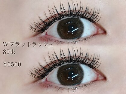 ユリ(yuri)の写真