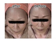ナチュール(Nature)の雰囲気（40代～60代の方も効果を実感！【毛穴洗浄/シミ/たるみ/小顔】）
