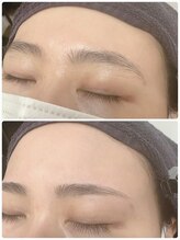 ワフトヒルズ 津田沼店(Waft Hills)/wax脱毛でツルツル肌に！！