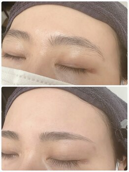 ワフトヒルズ 津田沼店(Waft Hills)/wax脱毛でツルツル肌に!!