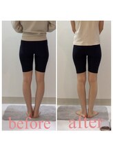 スタイルラボ高松/産後骨盤矯正の効果♪