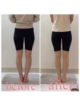 スタイルラボ高松/産後骨盤矯正の効果♪