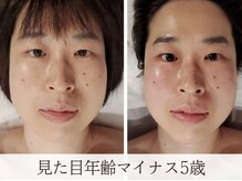 ミピマムの雰囲気（周りから気づかれる程の超小顔が叶う　コルギ/小顔/小顔矯正）