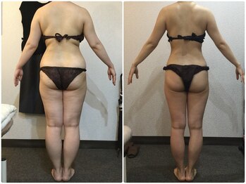 ウェリナ平和堂長久手院/小顔矯正/骨盤矯正/痩身/整体