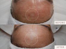 クラームビューティー(Clerm beauty)/【60代 女性】幹細胞プログラム