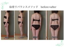 重だるさ、何となくの不調に◎「仙骨」から整える更年期ケア