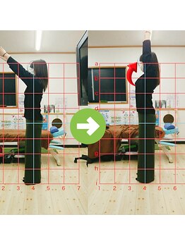サプライズ整体院/30代ママさんの肩こり初回結果