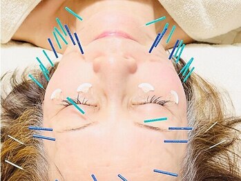 ウツクシ 三軒茶屋(UTUKUSHI)の写真/【初めての方大歓迎★リピーター多数】話題のヒト幹細胞美容鍼×フェイシャルで手では届かない深層ケアを◎