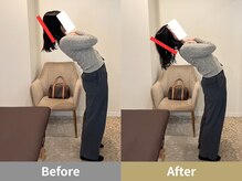 せなかのはね 井尻店/20代　肩こり　ストレートネック