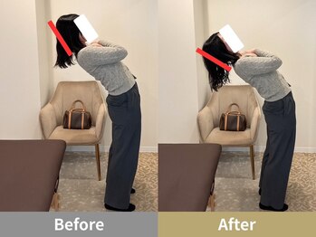 せなかのはね 井尻店/20代　肩こり　ストレートネック