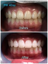 ドクターモック(Dr.MOC)/ＢＥＦＯＲＥ→ＡＦＴＥＲ