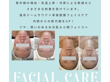 リブ 三軒茶屋(LiB)の雰囲気(立体フェイス造形!毛穴肌質改善速攻小顔&美肌ツヤ、ハリケア)