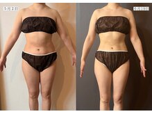 サロンドカメリア(salon de Camellia)/2ヶ月で８キロ減も可能！