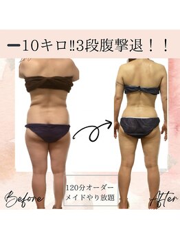 サロン ド ボーテ ラーンジュ 岐阜店(salon de beaut'e L'ange)/ハイパーナイフダイエット痩身