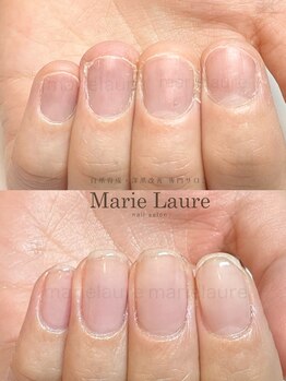 マリーロール 梅田店(Marie Laure)/深爪矯正/自爪育成/自爪風