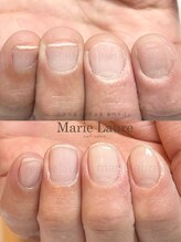 マリーロール 梅田店(Marie Laure)/深爪矯正/自爪育成/ネイルケア