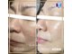 テテメルティ(te-te melty)の写真