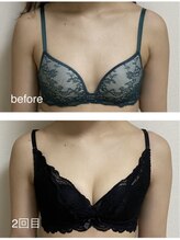 ルアナスタイル(Luana style)/