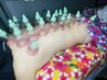 《男女共通》代謝up！カッピング　　4000円