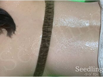 シードリン(Seedling)/スマーティ