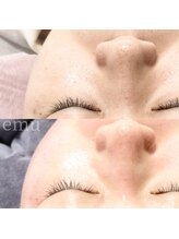 エミュ(emu)/くすみゼロ！