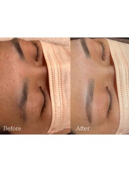 アイブロウメニューがあるサロン