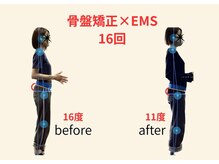 リボーン(REBORN)/整体/骨盤矯正/EMS