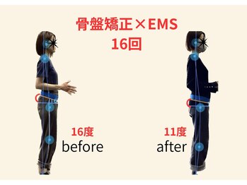 リボーン(REBORN)/整体/骨盤矯正/EMS