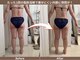 ゼロ シロカネ(ZERO SHIROKANE)の写真/【40代～自分磨き】最新痩身マシンで下半身のセル脂肪を分解&燃焼★下半身集中コース120分￥22000→￥10900