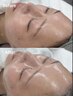 【再来】ノーファンデで輝く水光艶肌ララピール♪全顔+高保湿鎮静パック付