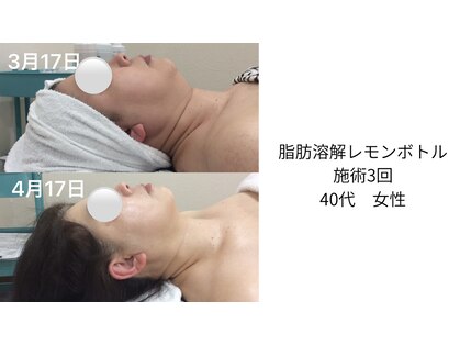 オン ザ スムース(ON THE SMOOOTH)の写真