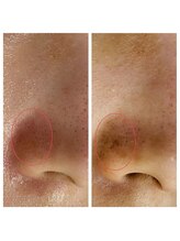 トータルビューティーサロン ナーズ(NAZ)/