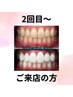 【2回目～の来店の方限定！】美白セルフホワイトニング 40分照射 ¥8200