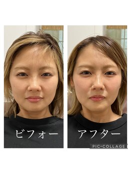 呼吸の音/疲れもむくみも改善！！