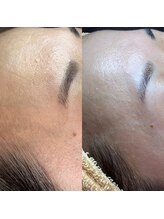 ミーミー 多治見店(MeMe.)/Wax脱毛