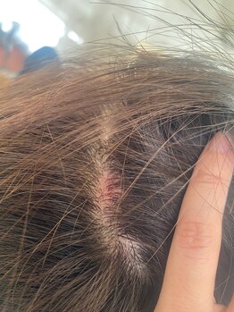 コル コルエ(koru korue)/ヘッドスパより効果持続します