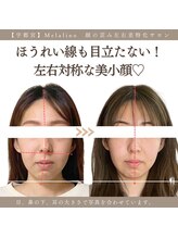 メラリノ(Melalino)/シンメトリー小顔整美