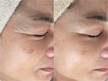 エナン(enan)/エンビロン120分トリートメント