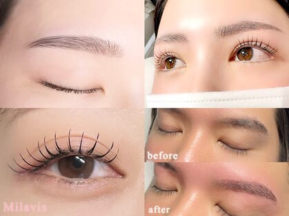 ミラビス(Milavis)の写真