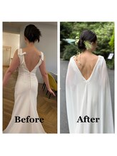 ライズ/お客様のビフォーアフター 