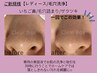 ご新規様限定【レディース毛穴洗浄】通常価格¥5,000→¥4,000