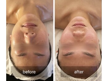 オフモード(OffMode)/バザルトフェイシャルヘッドスパ