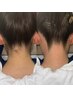 うなじWAX＋光脱毛セット☆彡
