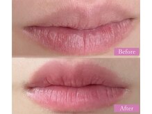 シェリ(Cheri)/ロ－マピンク