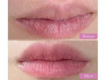 シェリ(Cheri)/ロ-マピンク