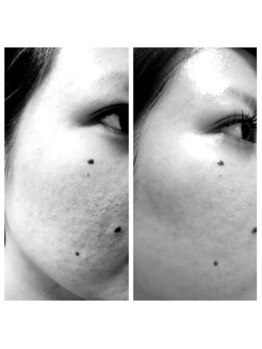 ユウウミ 那覇店(You海)/ラヴィーサビフォーアフター