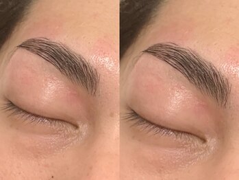 オズ(OZ)/新ハリウッドブロウリフト